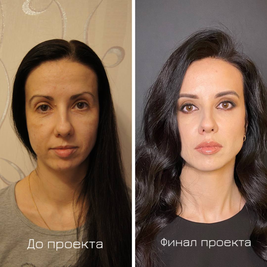 Проект преображения - участница Анна